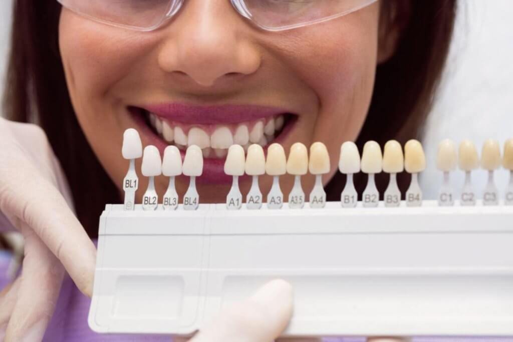5 Type Of Veneers